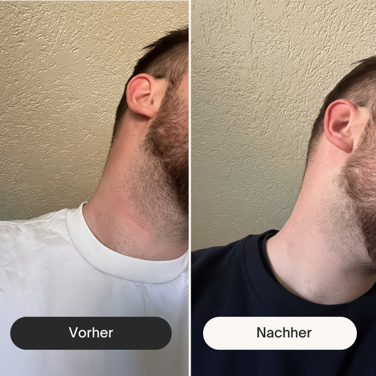 vorher, nachher