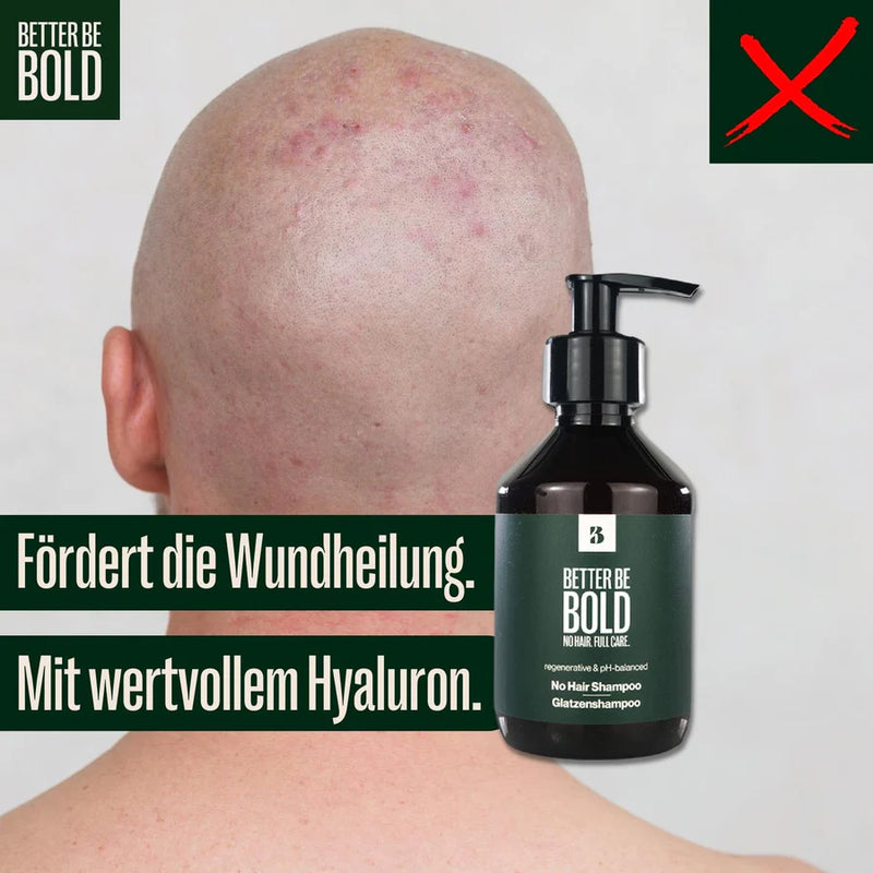 Pflegendes Glatzenshampoo (0-6mm) | No Hair Shampoo