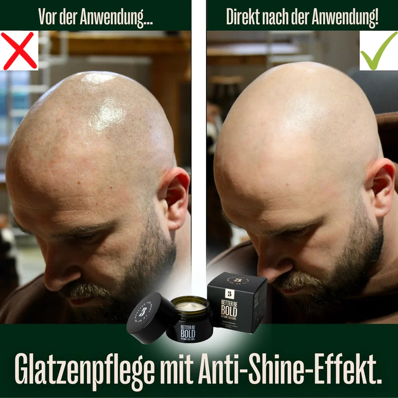 Pflegende Glatzencreme (0-3mm) mit natürlichem Anti-Shine-Effekt
